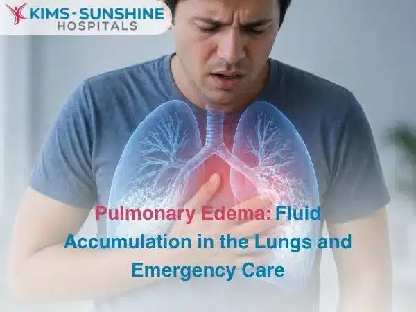 Pulmonary Edema_ Fluid Accumulation in the Lungs and Emergency Care