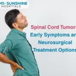 Spinal Cord Tumors_ Early Symptoms and Neurosurgical Treatment Options