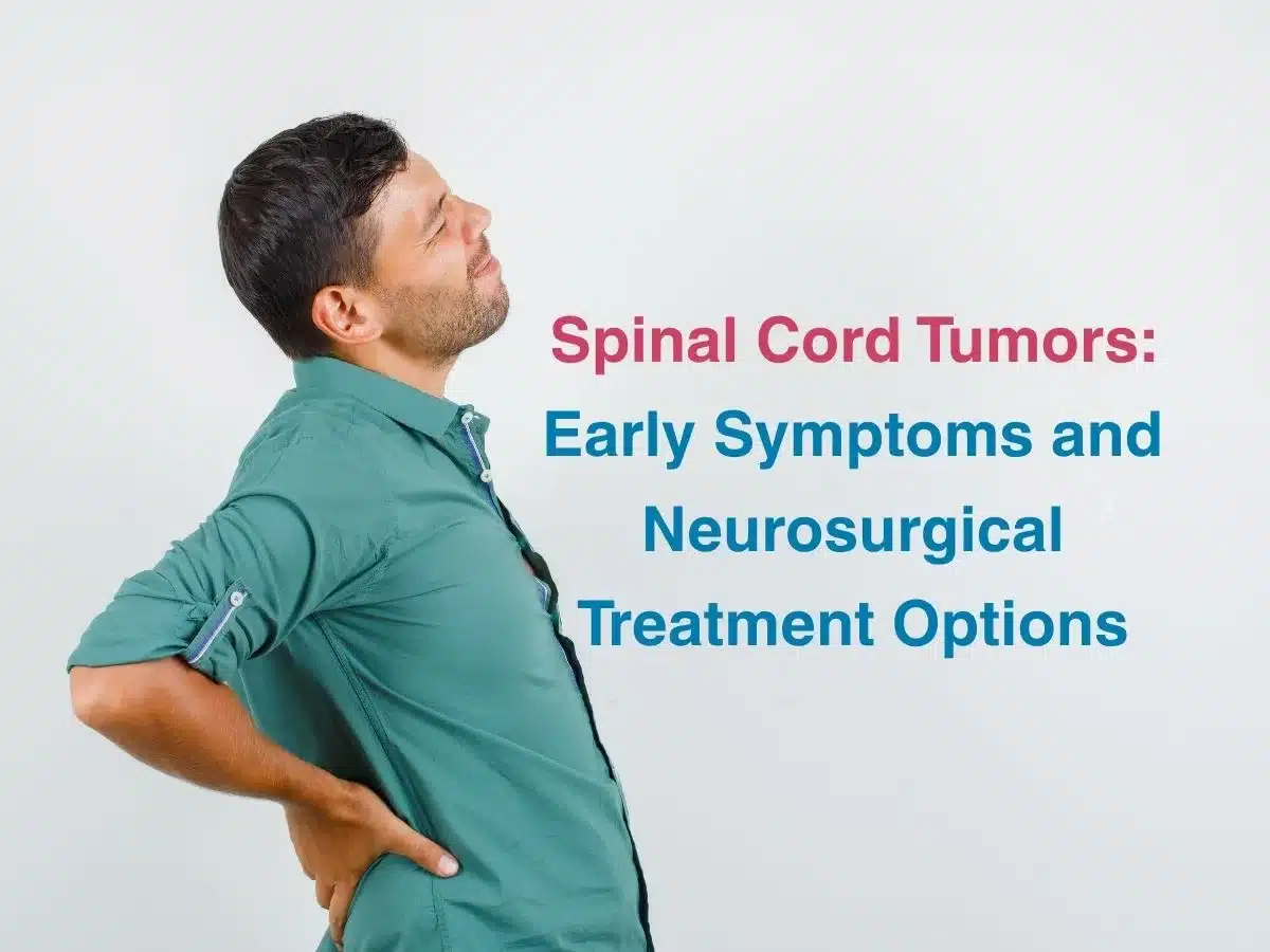 Spinal Cord Tumors_ Early Symptoms and Neurosurgical Treatment Options
