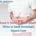 Blood in Stool Urine or Cough Warning Signs That Need Cancer Evaluation