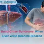Budd-Chiari Syndrome: When Liver Veins Become Blocked