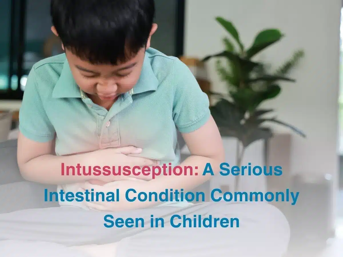 Intussusception: A Serious Intestinal Condition Commonly Seen in Children
