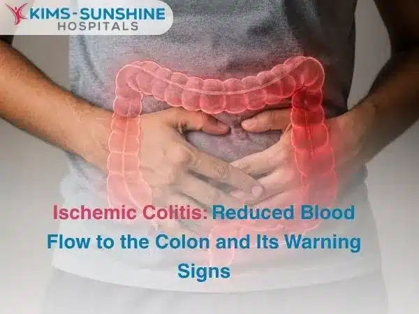 Ischemic Colitis: Reduced Blood Flow to the Colon and Its Warning Signs
