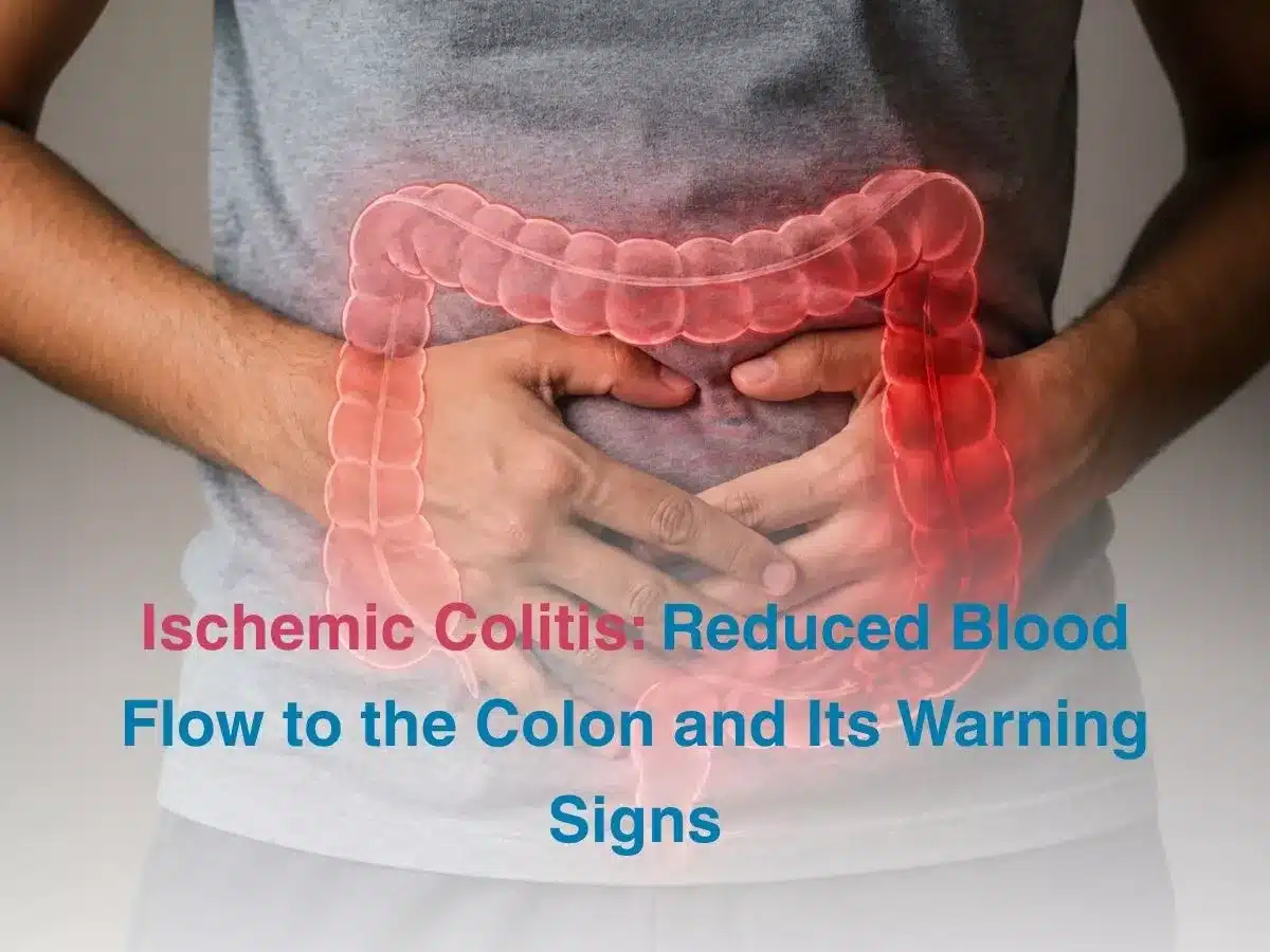 ischemic-colitis-reduced-blood-flow-to-the-colon-and-its-warning-signs-69fac3f3650a0 - Multispeciality Hospital Person holding their abdomen with a pink colon diagram overlaid and text about ischemic colitis warning signs.