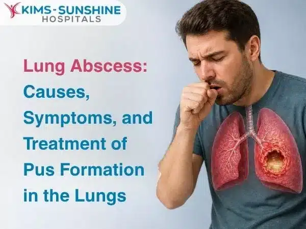 Lung Abscess: Causes, Symptoms, and Treatment of Pus Formation in the Lungs