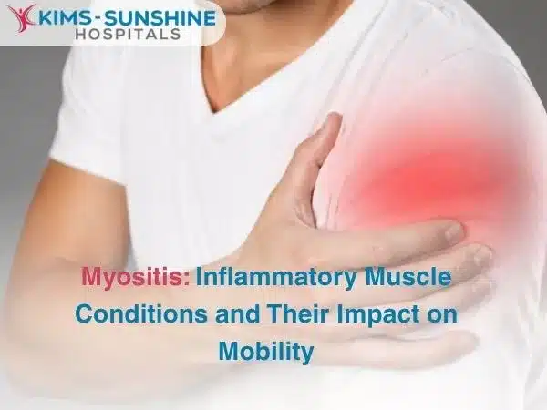 Myositis: Inflammatory Muscle Conditions and Their Impact on Mobility