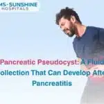 Pancreatic Pseudocyst: A Fluid Collection That Can Develop After Pancreatitis