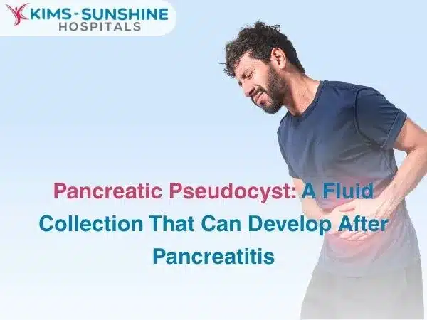 Pancreatic Pseudocyst: A Fluid Collection That Can Develop After Pancreatitis