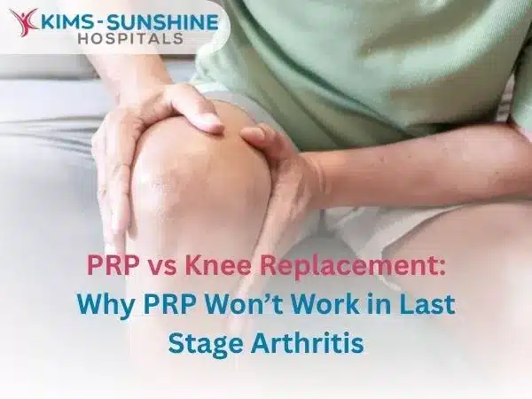 PRP vs Knee Replacement: Why PRP Won’t Work in Last Stage Arthritis