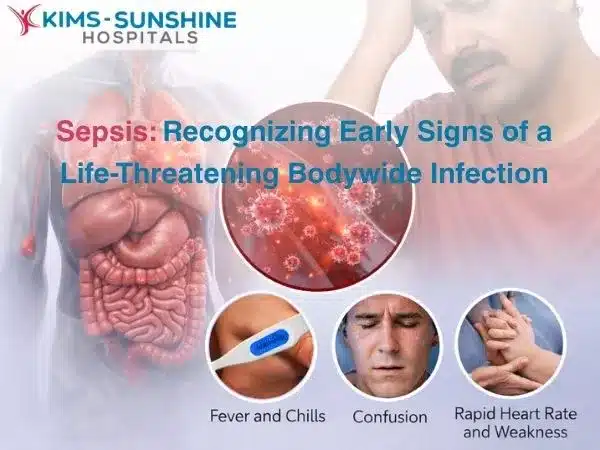 Sepsis: Recognizing Early Signs of a Life-Threatening Bodywide Infection