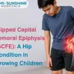 Slipped Capital Femoral Epiphysis (SCFE): A Hip Condition in Growing Children