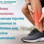 Stress Fractures: Overuse Injuries Common in Athletes and Active Individuals