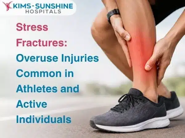 Stress Fractures: Overuse Injuries Common in Athletes and Active Individuals
