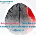 Subdural Hematoma: Brain Bleeding After Head Injury and When Surgery Is Required