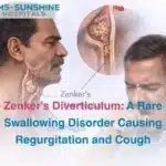 Zenker’s Diverticulum: A Rare Swallowing Disorder Causing Regurgitation and Cough