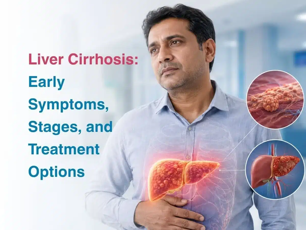 Liver Cirrhosis  Early Symptoms Stages and Treatment Options