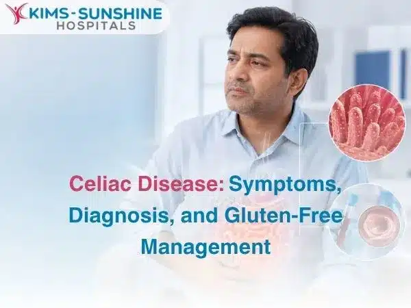 Celiac Disease  Symptoms Diagnosis and Gluten Free Management