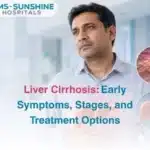 Liver Cirrhosis  Early Symptoms Stages and Treatment Options