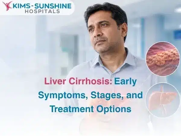 Liver Cirrhosis  Early Symptoms Stages and Treatment Options