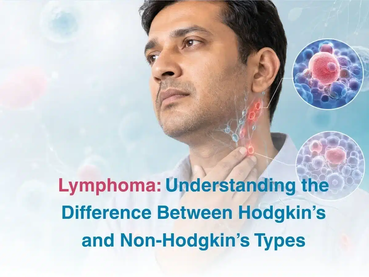 Lymphoma  Understanding the Difference Between Hodgkins and Non Hodgkins Types
