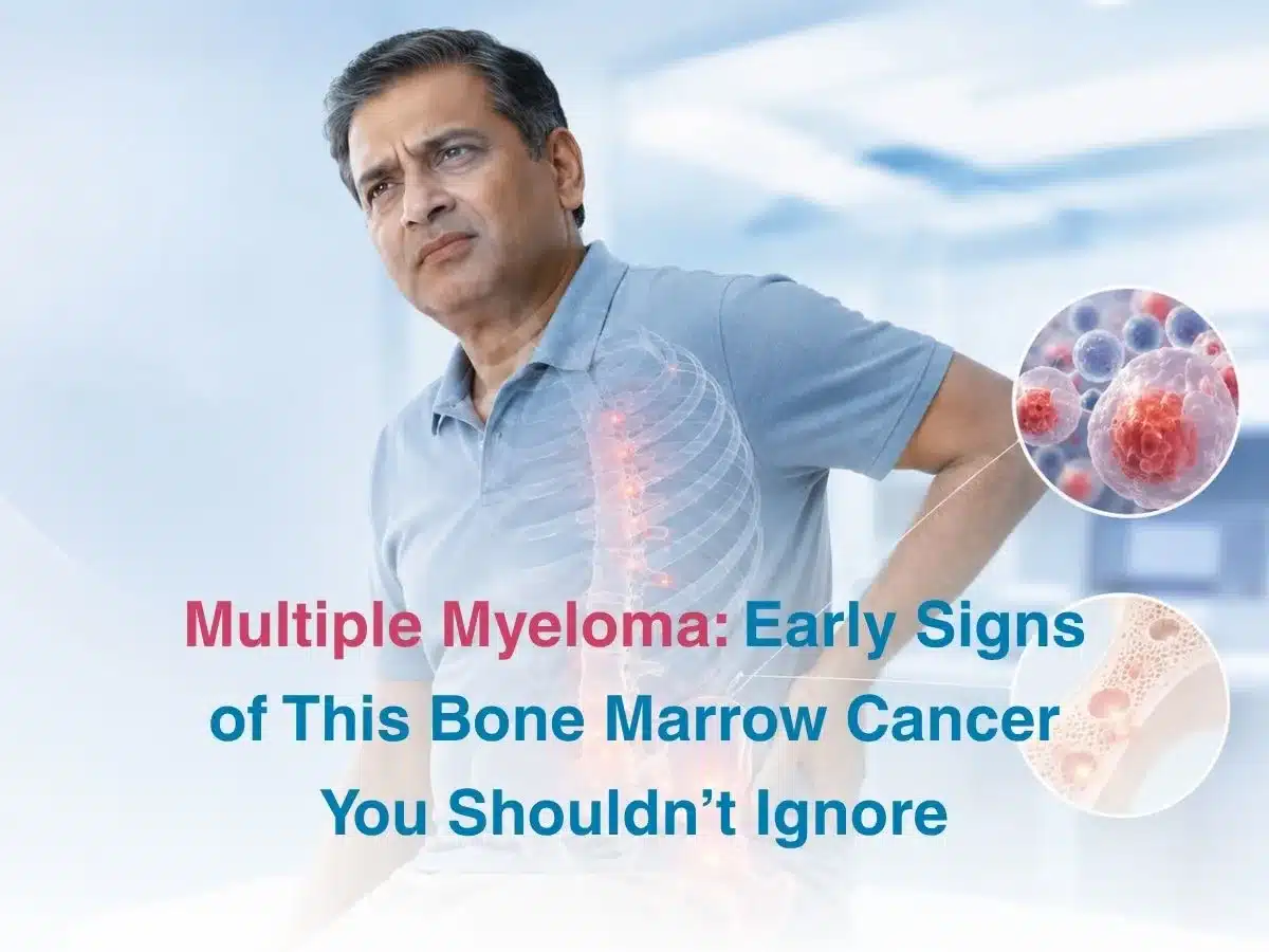 Multiple Myeloma Early Signs of This Bone Marrow Cancer You Shouldnt Ignore 1 Multispeciality Hospital Multiple Myeloma Early Signs of This Bone Marrow Cancer You Shouldnt Ignore