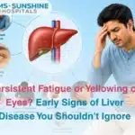 Persistent Fatigue or Yellowing of Eyes  Early Signs of Liver Disease You Shouldnt Ignore