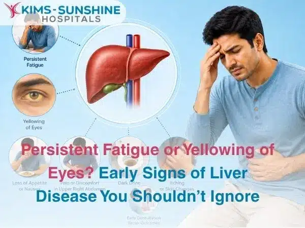 Persistent Fatigue or Yellowing of Eyes  Early Signs of Liver Disease You Shouldnt Ignore