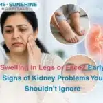 Swelling in Legs or Face  Early Signs of Kidney Problems You Shouldnt Ignore