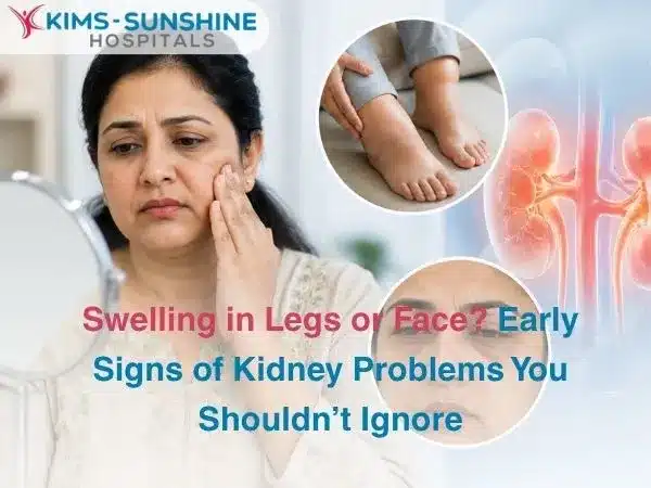 Swelling in Legs or Face  Early Signs of Kidney Problems You Shouldnt Ignore