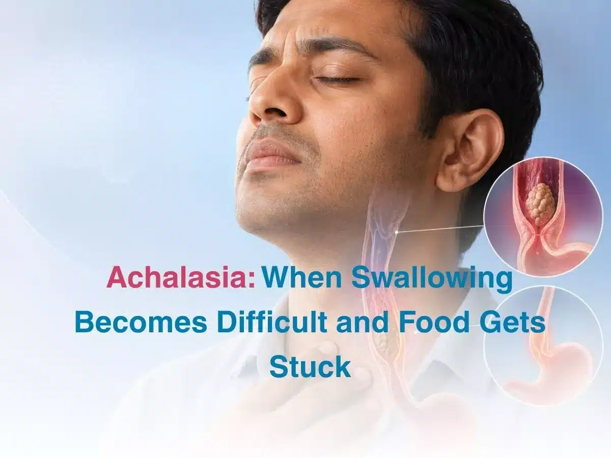 Informational graphic about achalasia showing a mans neck with an esophagus diagram and insets highlighting swallowing difficulties in the throat area