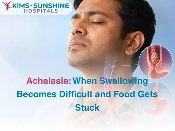 Achalasia When Swallowing Becomes Difficult and Food Gets Stuck