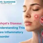 Behçets Disease Understanding This Rare Inflammatory Disorder
