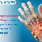 Pagets Disease of Bone Causes Symptoms and Treatment Options