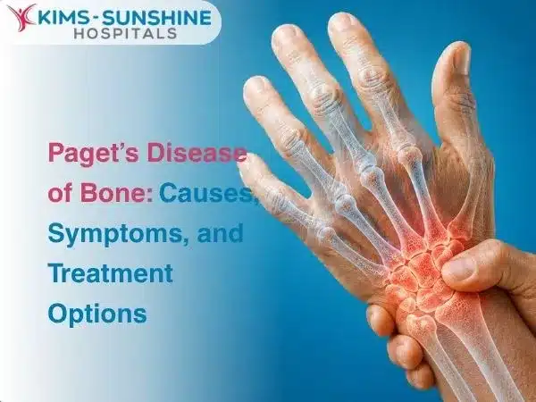 Pagets Disease of Bone Causes Symptoms and Treatment Options