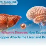 Wilsons Disease How Excess Copper Affects the Liver and Brain
